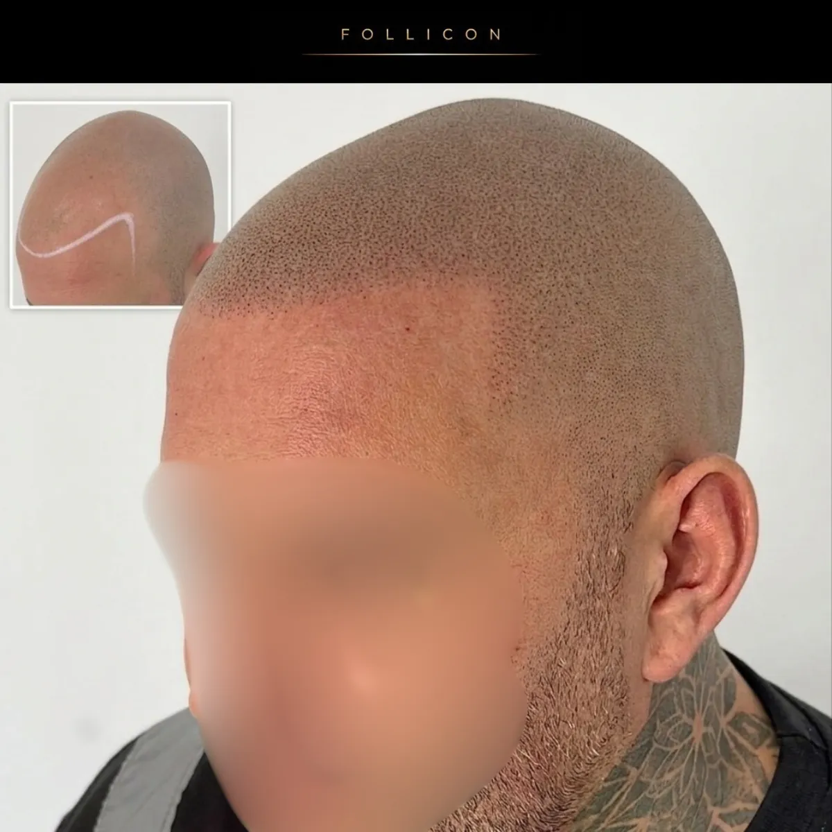Haarpigmentierung von Yavuz bei Golden Geometry